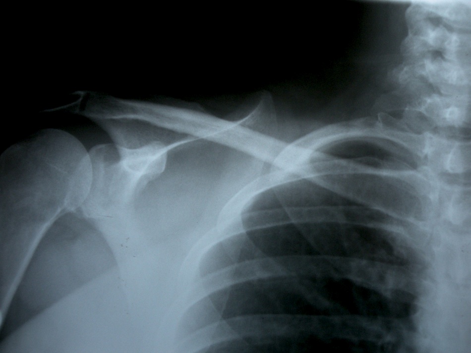 Original Photo by Brittany Greene