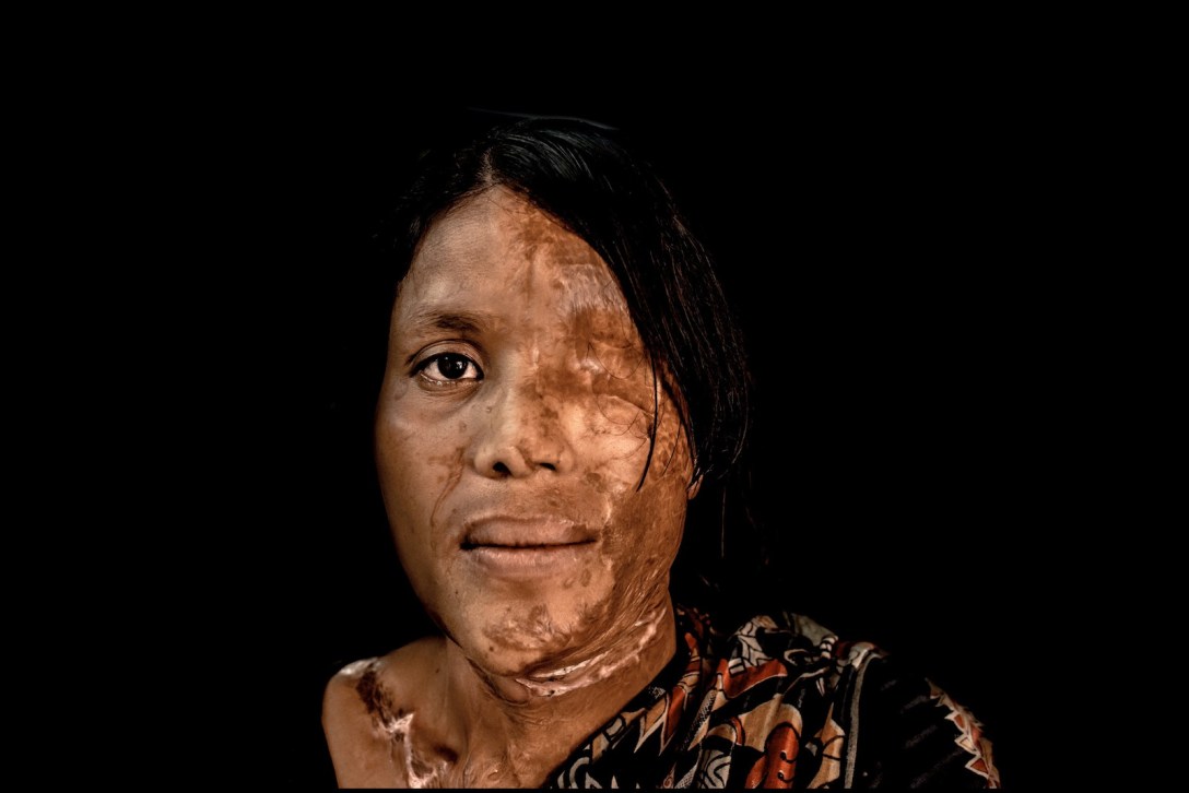 Original Photo by Zoriah (CC BY-NC 2.0)